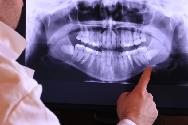 Best Dentist for Tooth Abscess  in Lake Darby, OH