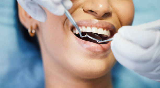 Best Dentist for Tooth Abscess  in Lake Darby, OH